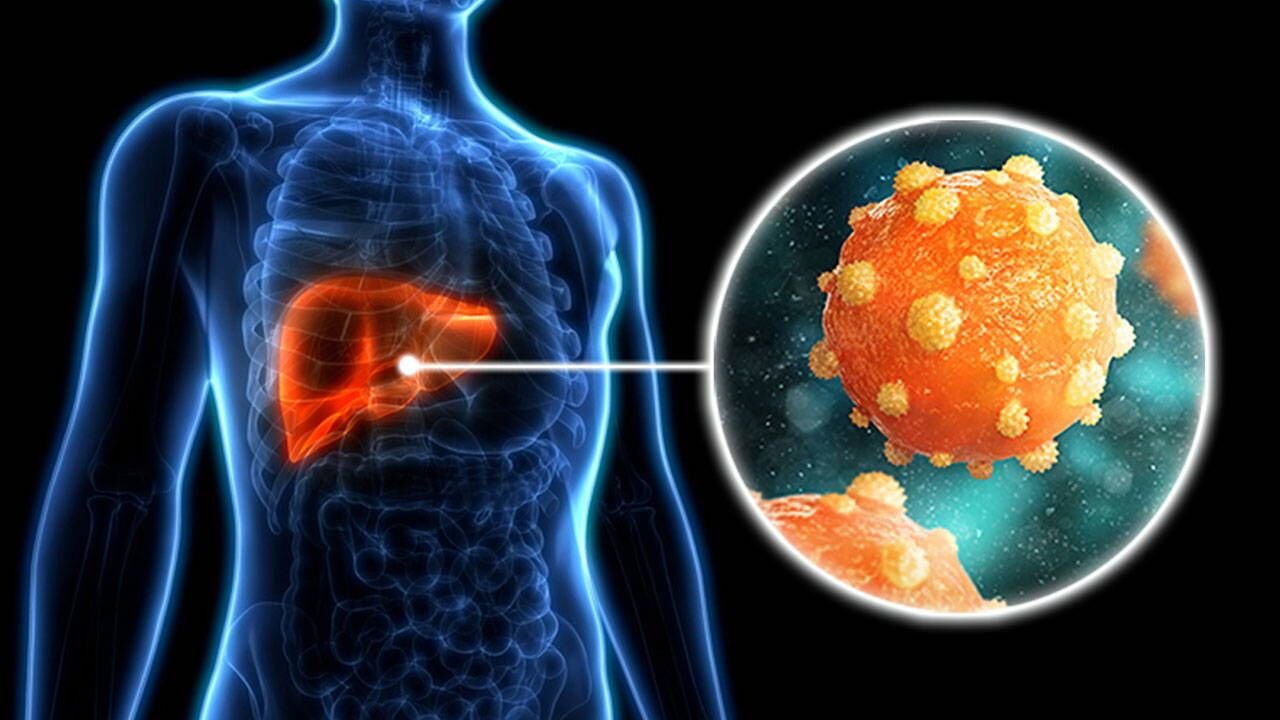 300 milyondan fazla kişi enfekte: Viral hepatitlere dikkat